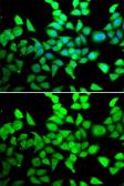 Anti-HDAC7 antibody used in Immunocytochemistry/ Immunofluorescence (ICC/IF). GTX55655