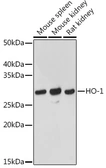 Anti-Heme Oxygenase 1 antibody used in Western Blot (WB). GTX55656