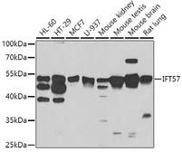 Anti-HIPPI antibody used in Western Blot (WB). GTX55658