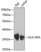Anti-HLA-DRA antibody used in Western Blot (WB). GTX55661