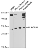 Anti-HLA-DRB1 antibody used in Western Blot (WB). GTX55662