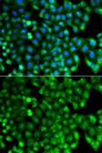Anti-HLA-DRB1 antibody used in Immunocytochemistry/ Immunofluorescence (ICC/IF). GTX55662