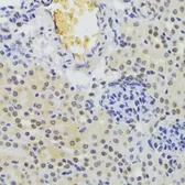 Anti-hnRNP A1 antibody used in IHC (Paraffin sections) (IHC-P). GTX55663
