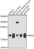 Anti-H-Ras antibody used in Western Blot (WB). GTX55665