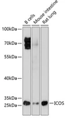 Anti-ICOS antibody used in Western Blot (WB). GTX55669