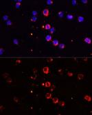 Anti-IL1 beta antibody used in Immunocytochemistry/ Immunofluorescence (ICC/IF). GTX55675