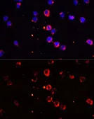 Anti-IL1 beta antibody used in Immunocytochemistry/ Immunofluorescence (ICC/IF). GTX55675