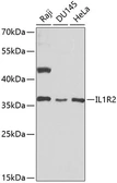 Anti-IL1 Receptor 2 antibody used in Western Blot (WB). GTX55676