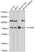 Anti-IL12 Receptor beta1 antibody used in Western Blot (WB). GTX55677