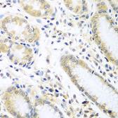 Anti-IL5 antibody used in IHC (Paraffin sections) (IHC-P). GTX55678