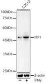 Anti-IRF1 antibody used in Western Blot (WB). GTX55681