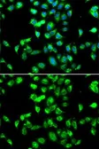 Anti-Kallistatin antibody used in Immunocytochemistry/ Immunofluorescence (ICC/IF). GTX55684