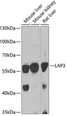 Anti-LAP3 antibody used in Western Blot (WB). GTX55688