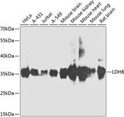 Anti-LDH-B antibody used in Western Blot (WB). GTX55689