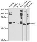 Anti-LIM2 antibody used in Western Blot (WB). GTX55691