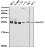 Anti-MAD2L1 antibody used in Western Blot (WB). GTX55694
