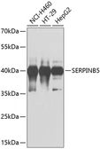 Anti-MASPIN antibody used in Western Blot (WB). GTX55696