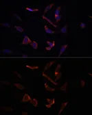 Anti-MCL1 antibody used in Immunocytochemistry/ Immunofluorescence (ICC/IF). GTX55698