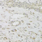 Anti-MDH2 antibody used in IHC (Paraffin sections) (IHC-P). GTX55700