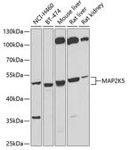 Anti-MEK5 antibody used in Western Blot (WB). GTX55702