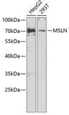 Anti-Mesothelin antibody used in Western Blot (WB). GTX55703