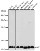 Anti-MIF antibody used in Western Blot (WB). GTX55704