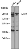 Anti-MLH1 antibody used in Western Blot (WB). GTX55706