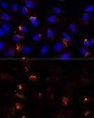 Anti-MMP3 antibody used in Immunocytochemistry/ Immunofluorescence (ICC/IF). GTX55709