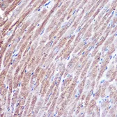 Anti-MYH1 antibody used in IHC (Paraffin sections) (IHC-P). GTX55717