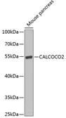 Anti-NDP52 antibody used in Western Blot (WB). GTX55720