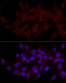 Anti-NDP52 antibody used in Immunocytochemistry/ Immunofluorescence (ICC/IF). GTX55720