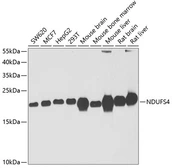 Anti-NDUFS4 antibody used in Western Blot (WB). GTX55722