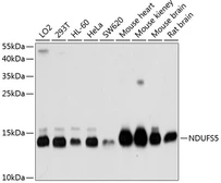 Anti-NDUFS5 antibody used in Western Blot (WB). GTX55723