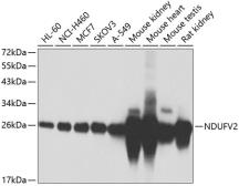 Anti-NDUFV2 antibody used in Western Blot (WB). GTX55724
