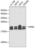 Anti-nm23-H1 antibody used in Western Blot (WB). GTX55727