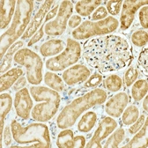 Anti-NRF2 antibody used in IHC (Paraffin sections) (IHC-P). GTX55732