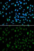 Anti-NSD3 antibody used in Immunocytochemistry/ Immunofluorescence (ICC/IF). GTX55733