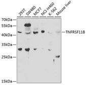 Anti-OPG antibody used in Western Blot (WB). GTX55734