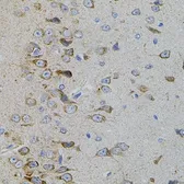 Anti-p38 beta antibody used in IHC (Paraffin sections) (IHC-P). GTX55736