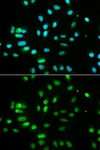 Anti-PAX3 antibody used in Immunocytochemistry/ Immunofluorescence (ICC/IF). GTX55738