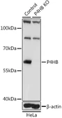 Anti-PDI antibody used in Western Blot (WB). GTX55742