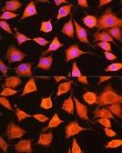 Anti-PHKG2 antibody used in Immunocytochemistry/ Immunofluorescence (ICC/IF). GTX55746