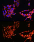 Anti-PI3 kinase p110 alpha antibody used in Immunocytochemistry/ Immunofluorescence (ICC/IF). GTX55747