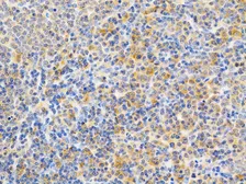 Anti-PKC epsilon antibody used in IHC (Paraffin sections) (IHC-P). GTX55749