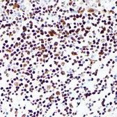 Anti-PML antibody used in IHC (Paraffin sections) (IHC-P). GTX55751