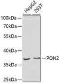 Anti-PON2 antibody used in Western Blot (WB). GTX55753