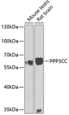 Anti-PPP3CC antibody used in Western Blot (WB). GTX55755