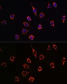 Anti-Presenilin 1 antibody used in Immunocytochemistry/ Immunofluorescence (ICC/IF). GTX55757