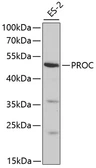 Anti-Protein C antibody used in Western Blot (WB). GTX55759