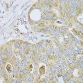 Anti-PSG1 antibody used in IHC (Paraffin sections) (IHC-P). GTX55761